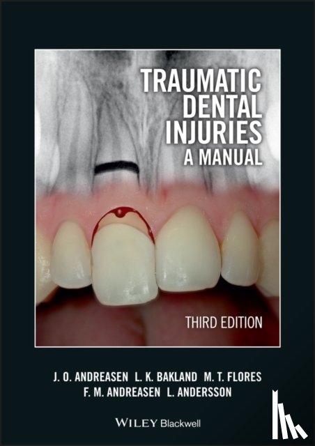 Andreasen, Jens O. (University Hospital (Rigshospitalet), Bakland, Leif K. (Loma Linda University, Flores, Maria Teresa (University of Valparaiso, Andreasen, Frances M. (University Hospital (Rigshospitalet) - Traumatic Dental Injuries