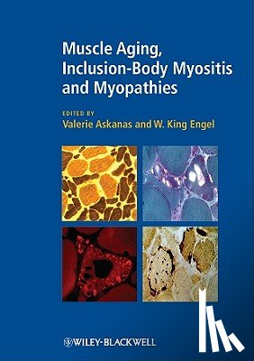  - Muscle Aging, Inclusion-Body Myositis and Myopathies