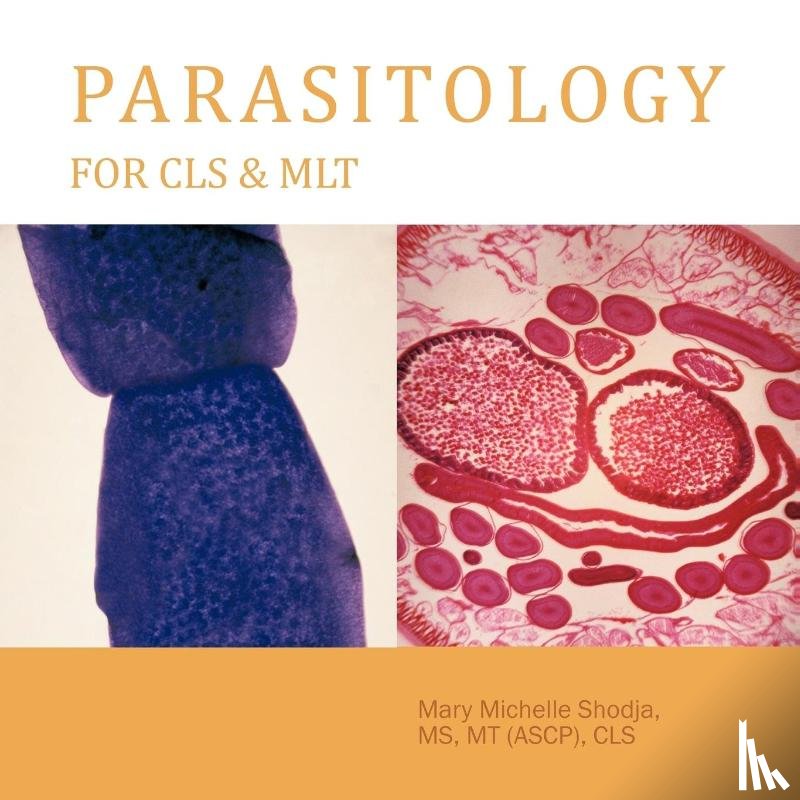 Shodja MS MT (ASCP) CLS, Mary Michelle - Parasitology For CLS & MLT