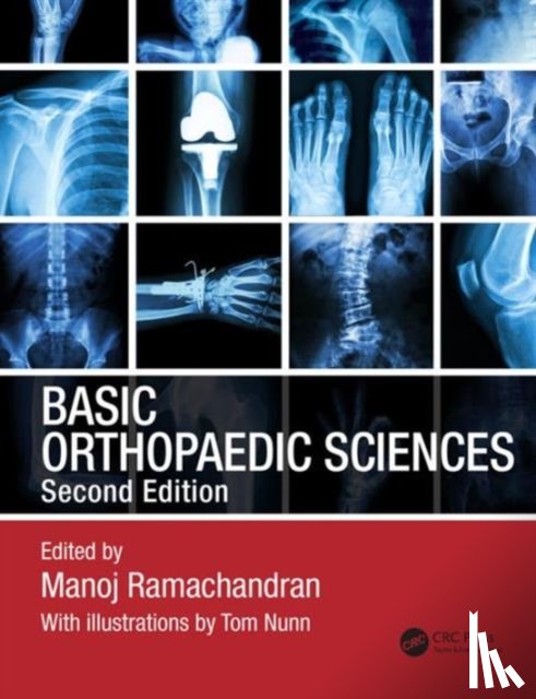  - Basic Orthopaedic Sciences