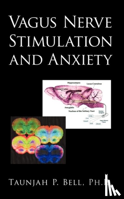 Bell, Taunjah P - Vagus Nerve Stimulation and Anxiety