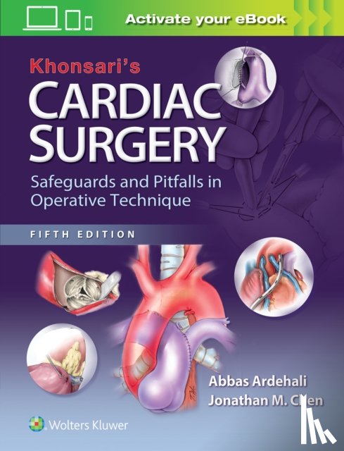 Ardehali, Abbas, Chen, Jonathan M. - Khonsari's Cardiac Surgery: Safeguards and Pitfalls in Operative Technique