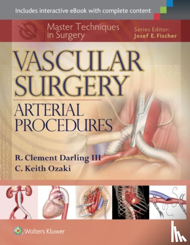 Darling, R. Clement, Ozaki, C. Keith - Master Techniques in Surgery: Vascular Surgery: Arterial Procedures