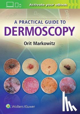 Markowitz, Orit - A Practical Guide to Dermoscopy
