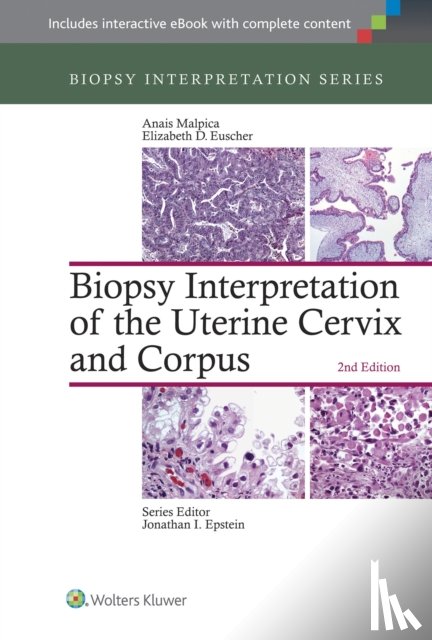  - Biopsy Interpretation of the Uterine Cervix and Corpus