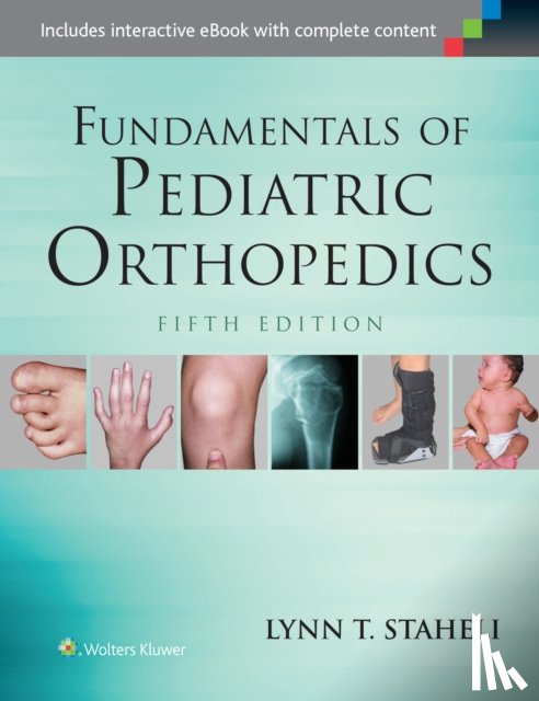 Staheli, Lynn T. - Fundamentals of Pediatric Orthopedics