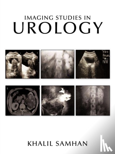 SAMHAN, KHALIL-AHMAD - Imaging Studies in Urology