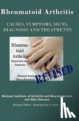 Smith, S. - Rheumatoid Arthritis: Causes, Symptoms, Signs, Diagnosis and Treatments - Revised Edition - Illustrated by S. Smith