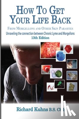 Kalmbah, Jonquelyn - How to Get Your Life Back From Morgellons and Other Skin Parasites Limited Edit