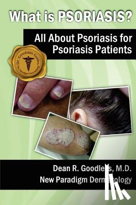 Goodless MD, Dean R. - What is Psoriasis?: All About Psoriasis for Psoriasis Patients