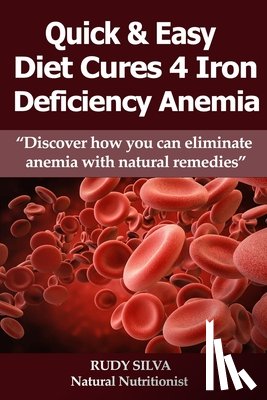 Silva, Rudy S. - Anemia: Iron Deficiency Diet: Anemia: Iron Deficiency