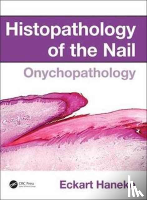 Haneke, Eckart (University of Berne - Histopathology of the Nail
