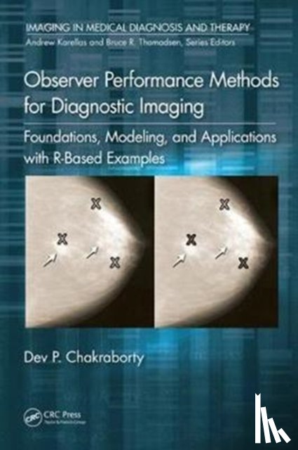 Chakraborty, Dev P. - Observer Performance Methods for Diagnostic Imaging