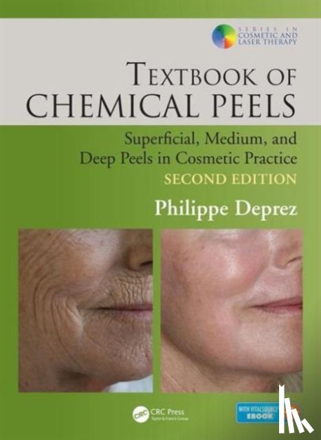 Deprez, Philippe (Clinical Hera - Textbook of Chemical Peels