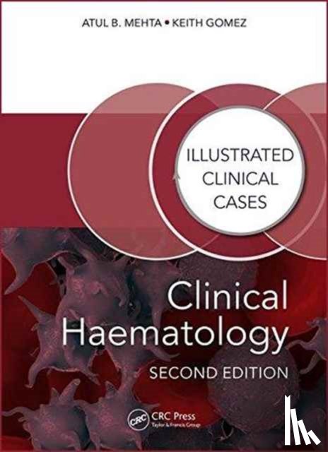 Mehta, Atul Bhanu (Consultant Haematologist, Gomez, Keith (Royal Free Hampstead N H S Trust - Clinical Haematology