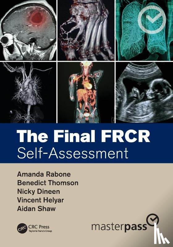 Rabone, Amanda (MTW NHS Trust, Thomson, Benedict (GSTT NHS Trust, Dineen, Nicky (MTW NHS Trust, Helyar, Vincent (HHFT NHS - The Final FRCR