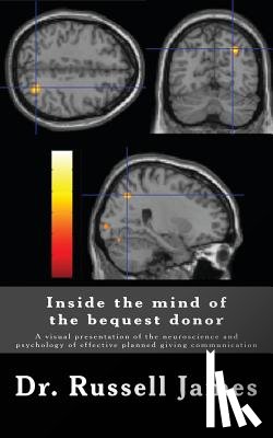 James III, Russell - Inside the mind of the bequest donor: A visual presentation of the neuroscience and psychology of effective planned giving communication