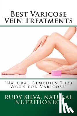 Silva, Rudy Silva - Best Varicose Vein Treatments: Natural Remedies That Work for Varicose