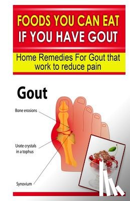Goodman, Doc - FOODS YOU CAN EAT IF YOU HAVE GOUT