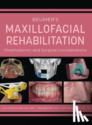 Sharma, Arun - Beumer's Maxillofacial Rehabilitation: Prosthodontics and Surgical Considerations