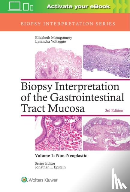 Montgomery, Elizabeth A., Voltaggio, Lysandra - Biopsy Interpretation of the Gastrointestinal Tract Mucosa: Volume 1: Non-Neoplastic