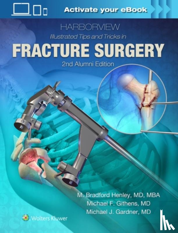 Henley, M. - Harborview Illustrated Tips and Tricks in Fracture Surgery