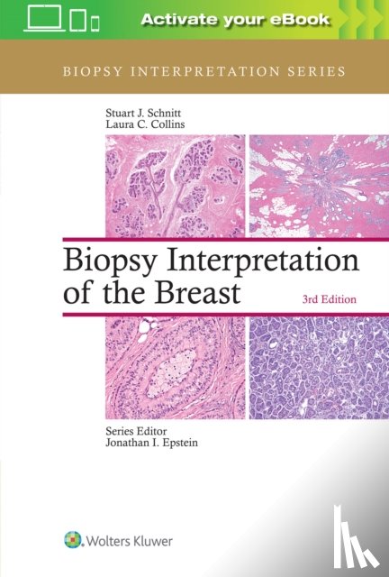 Schnitt, Stuart J., Collins, Laura C. - Biopsy Interpretation of the Breast