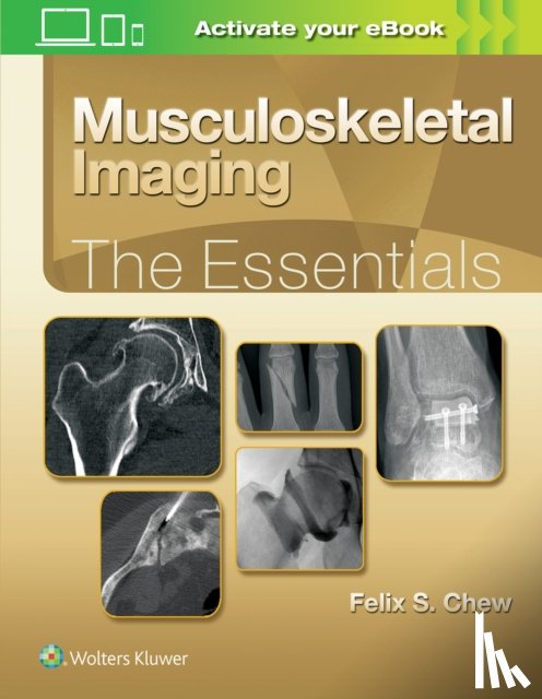 Chew, Felix S. - Musculoskeletal Imaging: The Essentials