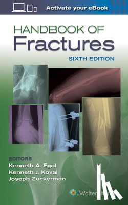  - Handbook of Fractures