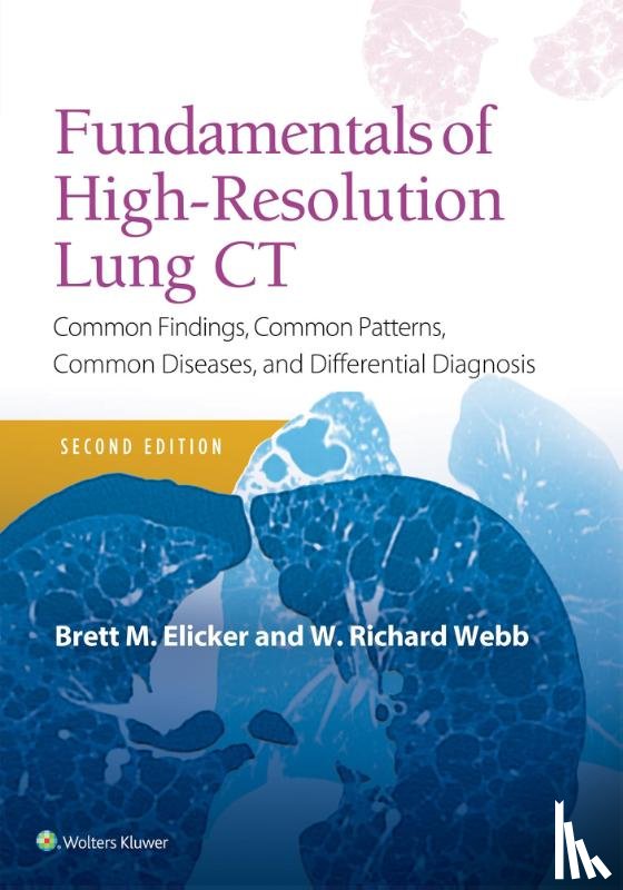 Elicker, Brett M, Webb, W. Richard - Fundamentals of High-Resolution Lung CT
