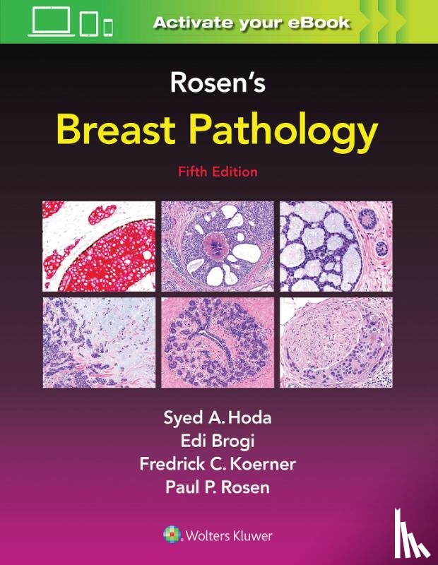 Hoda, Syed A., Rosen, Paul Peter, Brogi, Edi, Koerner, Frederick C. - Rosen's Breast Pathology
