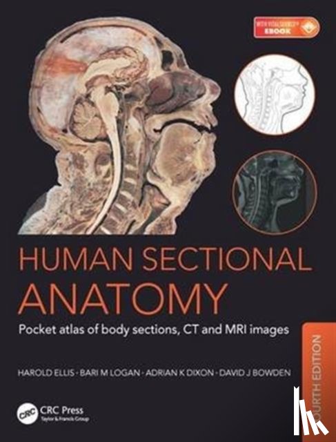 Dixon, Adrian Kendal, Bowden, David J. (Abdominal Imaging Fellow, Department of Medical Imaging Sunnybrook Health Sciences Centre, Toronto, Canada and Formerly Teaching Bye-Fellow Christ’s College University of Cambridge, UK) - Human Sectional Anatomy