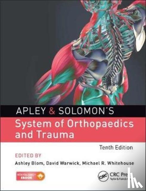 Blom, Ashley - Apley & Solomon¿s System of Orthopaedics and Trauma