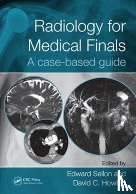  - Radiology for Medical Finals