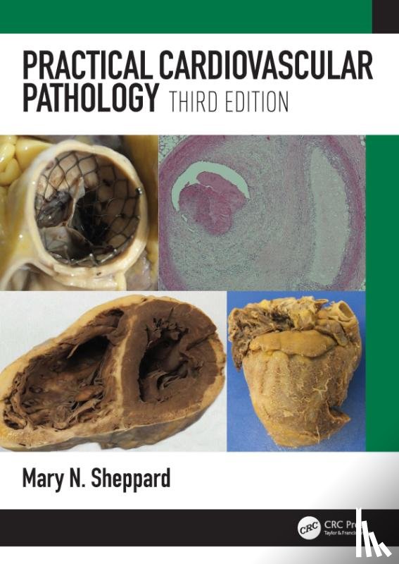 Sheppard, Mary N. (St. George's University of London - Practical Cardiovascular Pathology