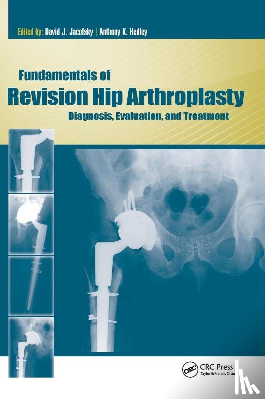 Jacofsky, David, Hedley, Anthony - Fundamentals of Revision Hip Arthroplasty