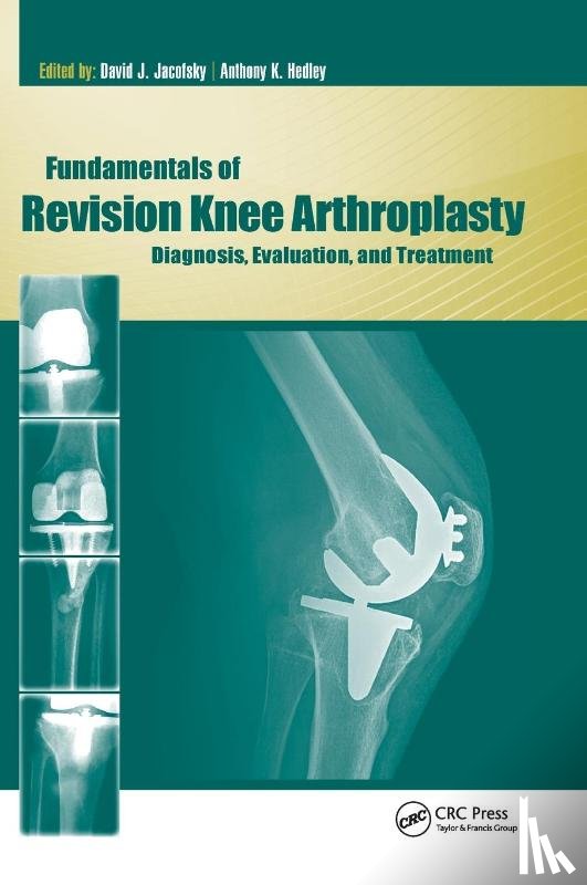 Jacofsky, David, Hedley, Anthony - Fundamentals of Revision Knee Arthroplasty