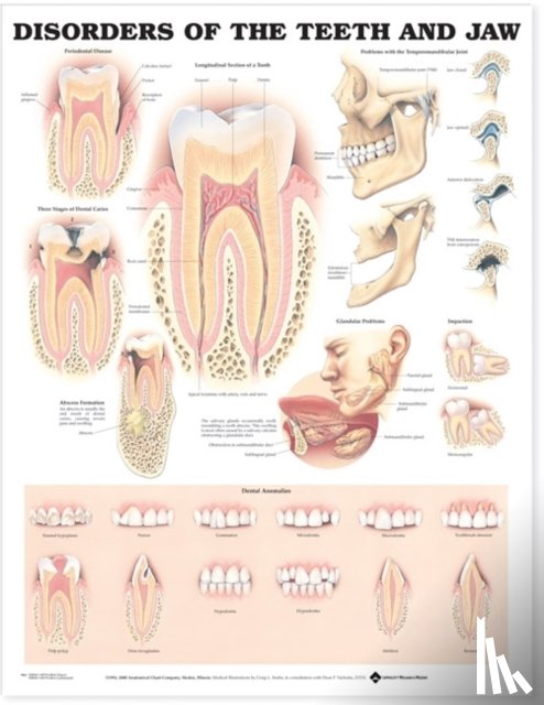 Anatomical Chart Company - Disorders of the Teeth and Jaw Anatomical Chart