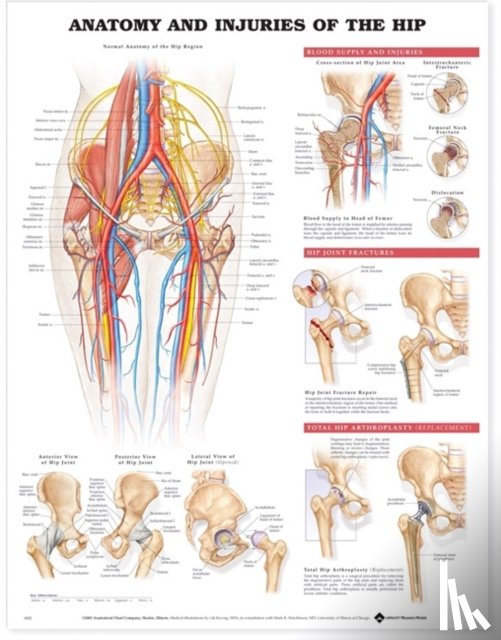 Anatomical Chart Company - Anatomy and Injuries of the Hip Anatomical Chart