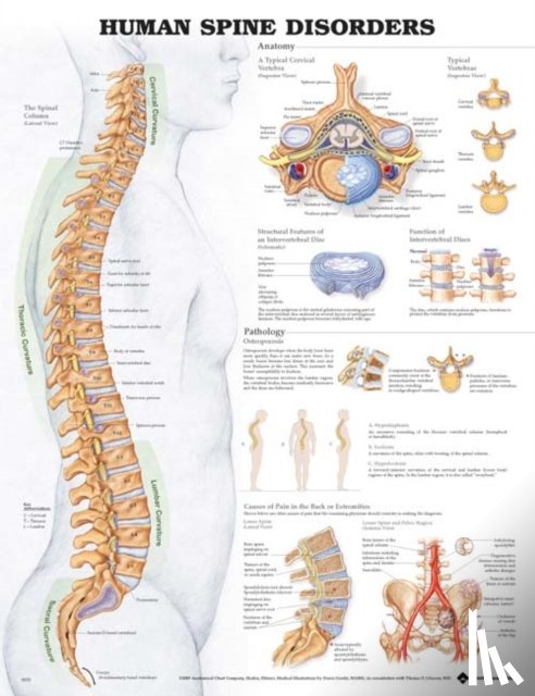 Anatomical Chart Company - Human Spine Disorders Anatomical Chart