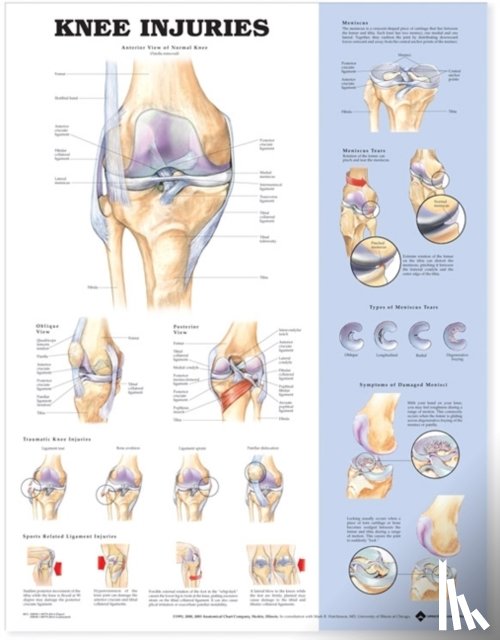  - Knee Injuries Anatomical Chart