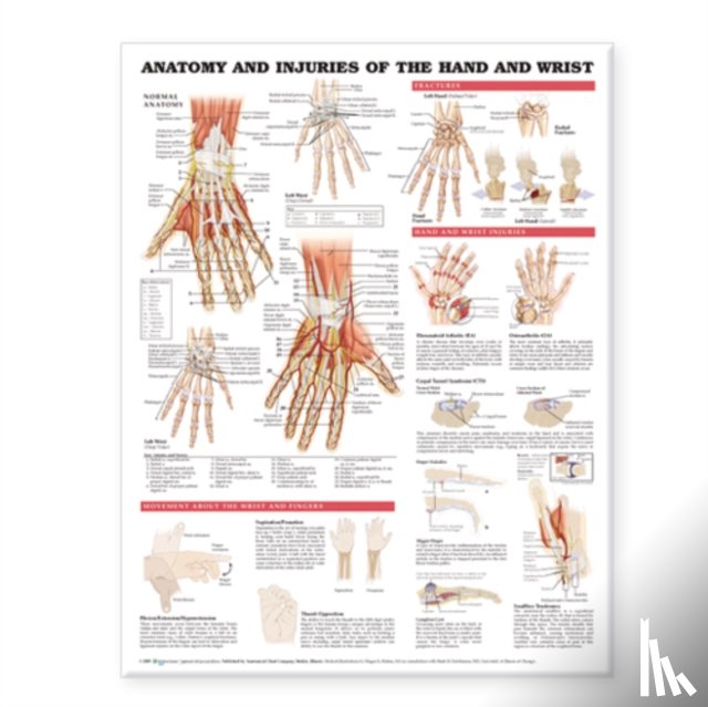 Anatomical Chart Company - Anatomy and Injuries of the Hand and Wrist Anatomical Chart