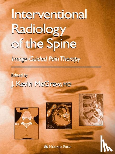 J. Kevin McGraw - Interventional Radiology of the Spine
