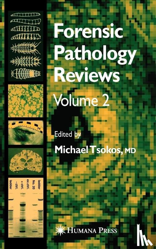  - Forensic Pathology Reviews Vol 2