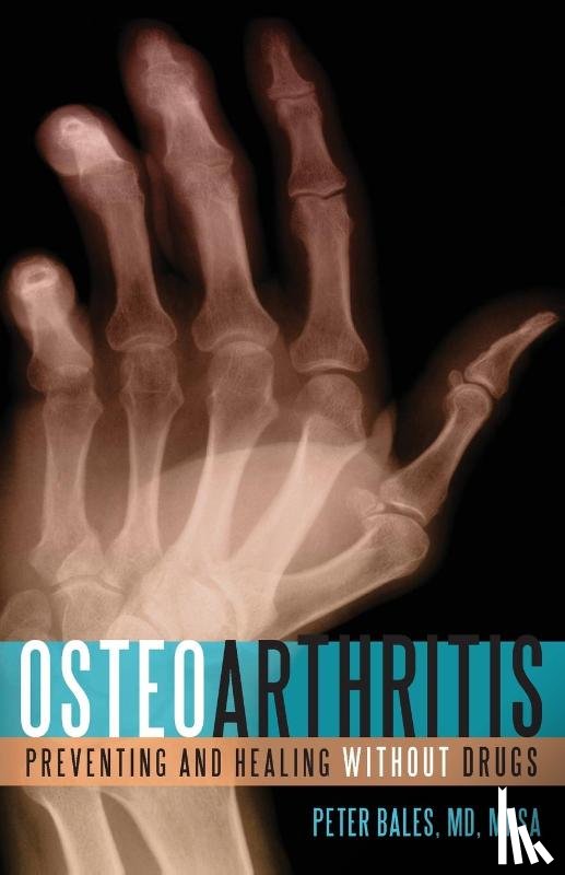 Bales, Peter - Osteoarthritis