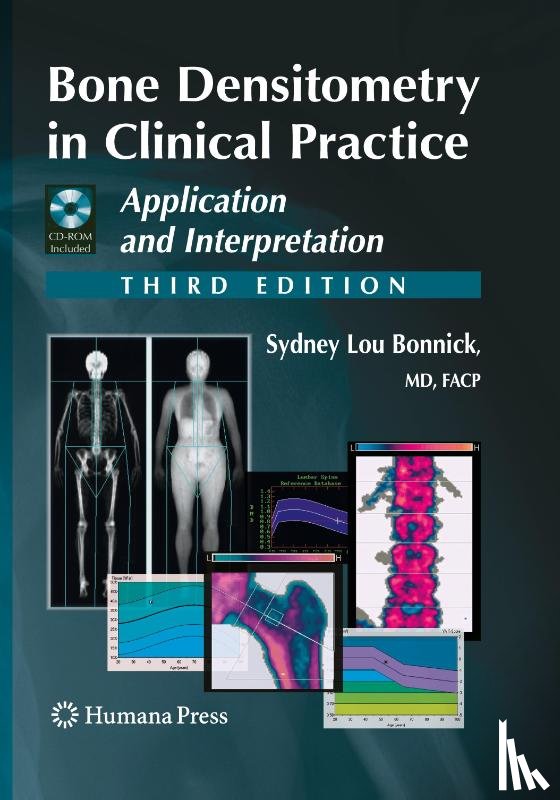 Bonnick, Sydney Lou - Bone Densitometry in Clinical Practice