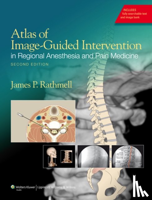 Rathmell, James P. - Atlas of Image-Guided Intervention in Regional Anesthesia and Pain Medicine