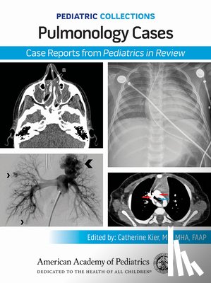 American Academy of Pediatrics (Aap) - Pediatric Collections: Pulmonology Cases: Case Reports from Pediatrics in Review
