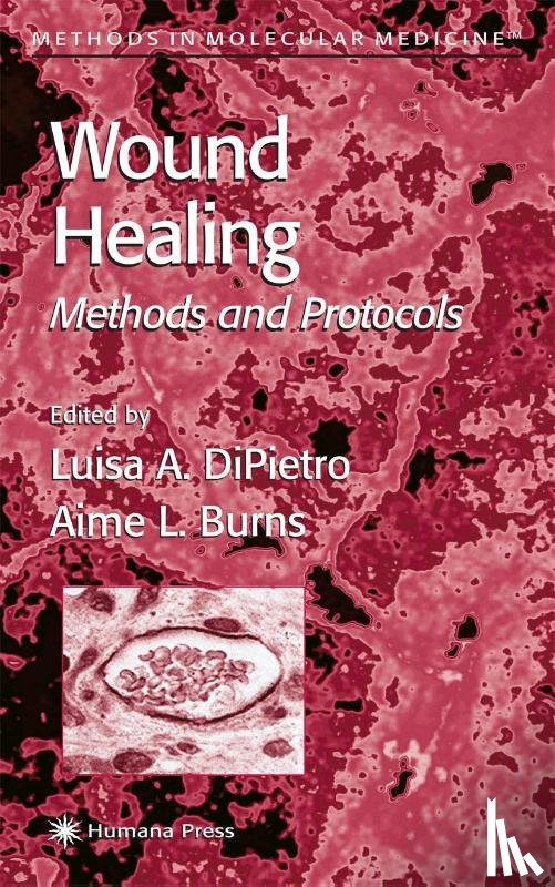 Luisa A. DiPietro, Aime L. Burns - Wound Healing