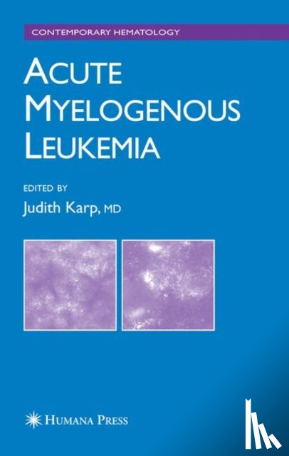 - Acute Myelogenous Leukemia